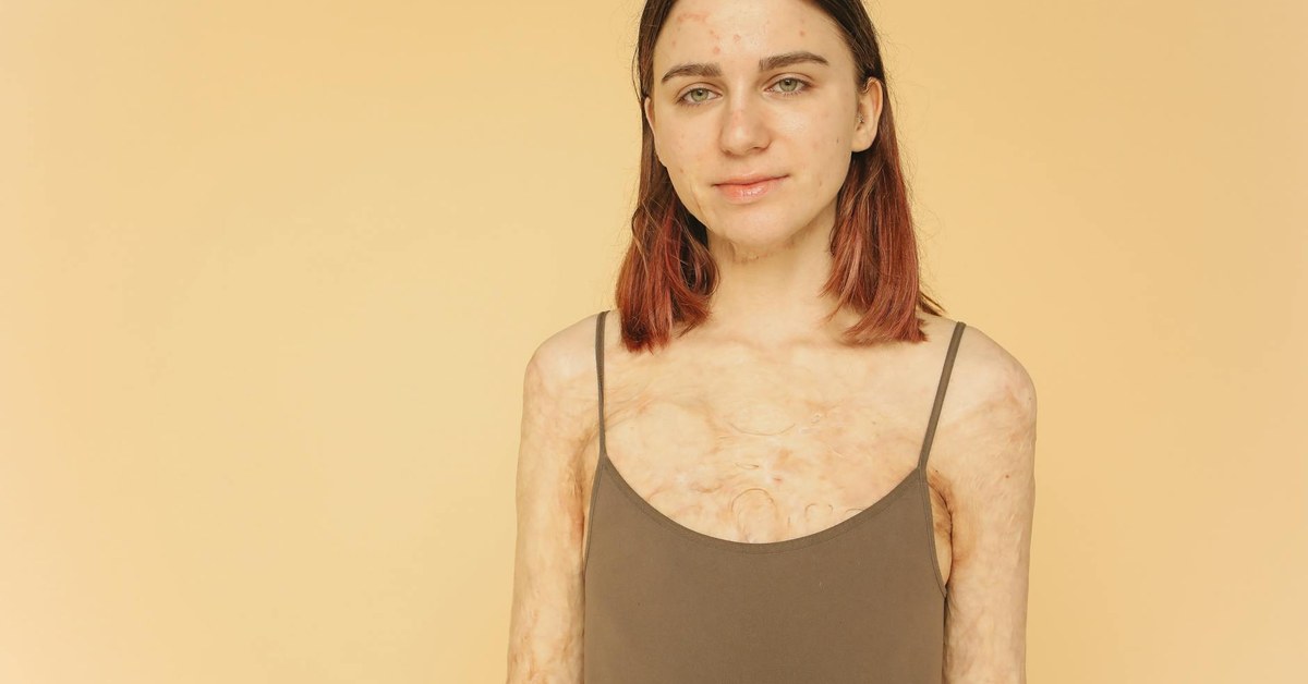 Beyond the Scars — Cultivating Body Confidence After Life-Altering Surgery or Illness