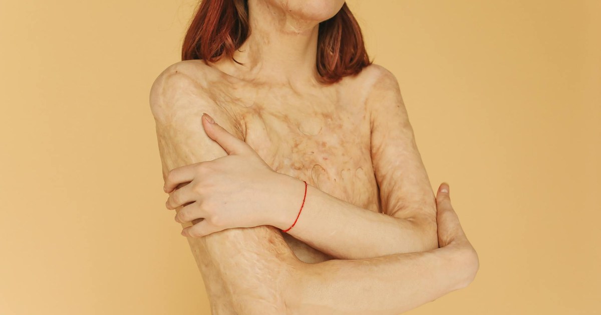 Healing Your Body Relationship — A Self-Compassion Guide for Unshakeable Confidence