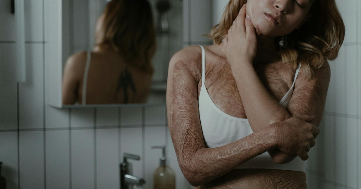 Overcome Body Image Anxiety — Confidently Navigate Social Events & Gatherings